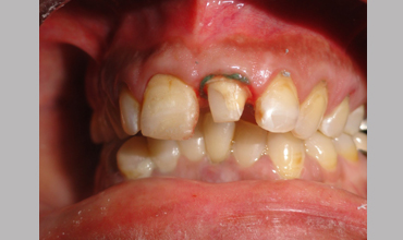 Dental hospital in Anand                        